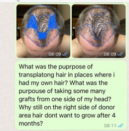 whatsapp mesajı saç ekimi kliniği 6